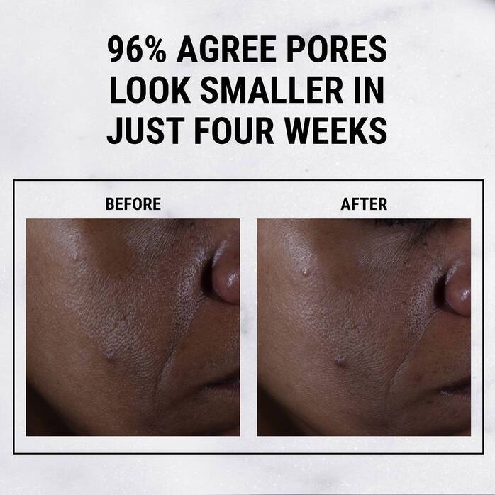 Kiehl's Ultra Pure High-Potency Serum 9.8% Glycolic Acid (30ml) - Best Buy World Singapore