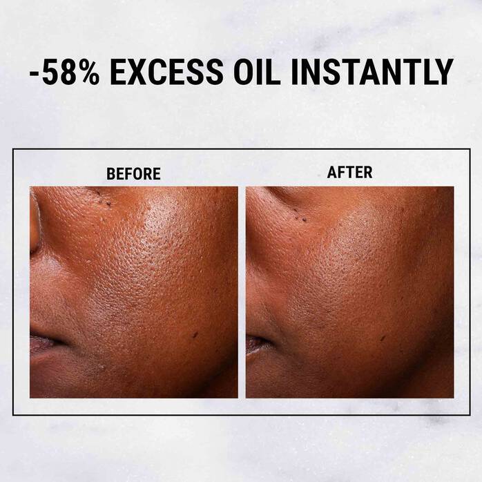 Kiehl's Ultra Pure High-Potency Serum 5.0% Niacinamide (30ml) - Best Buy World Singapore